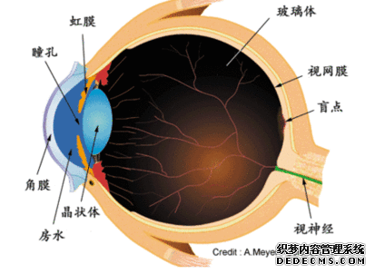 义眼适合什么样的患者？